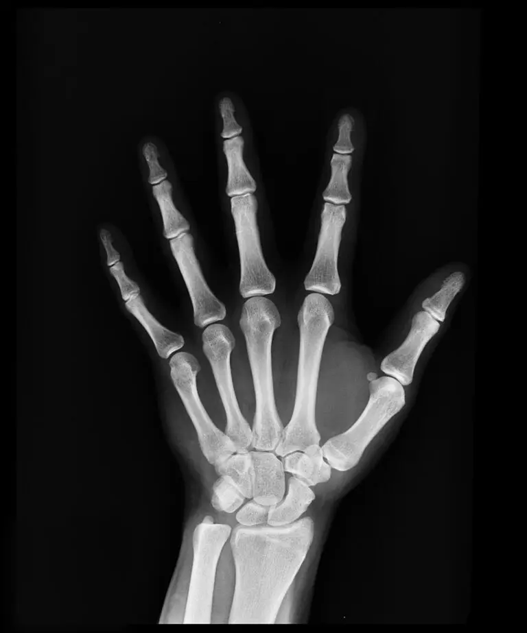 Chiropractor examining spinal X-ray on digital screen in clinic