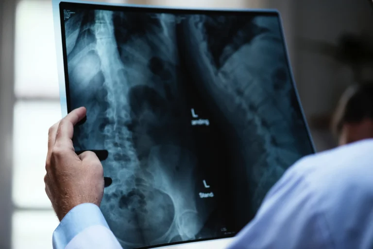 Chiropractor assessing a patient with scoliosis