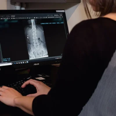 Chiropractor examining spinal x-ray image in clinic