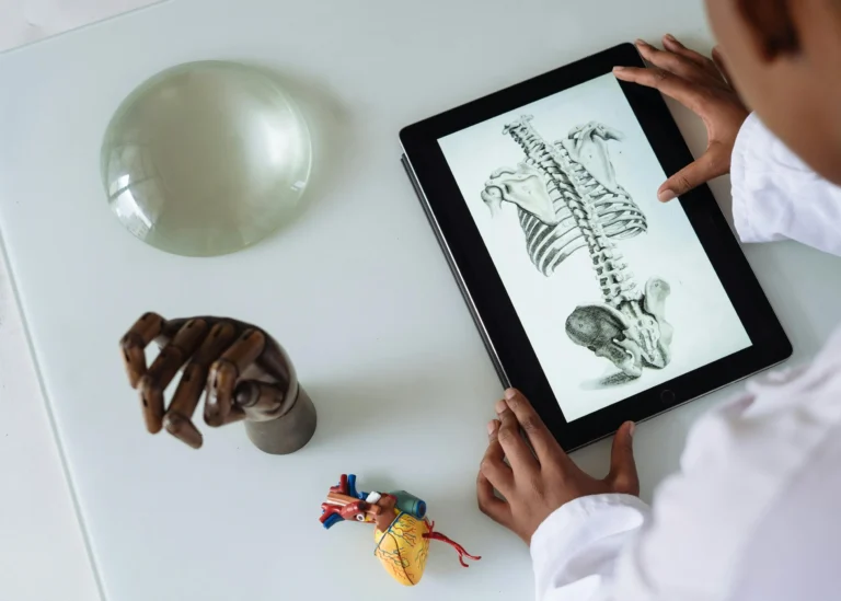 Illustration of vertebral subluxation complex in chiropractic care